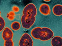 an image of an infection with the Vancomycin-Resistant Enterococcus bacteria